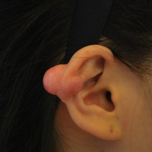 整形前后对比图片