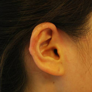 整形前后对比图片