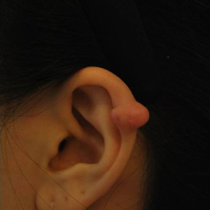 整形前后对比图片