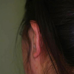 整形前后对比图片