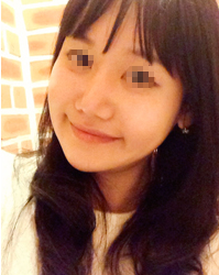 整形前后对比图片