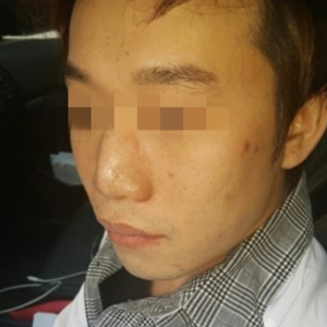 整形前后对比图片