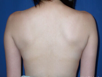 整形前后对比图片