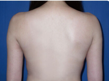 整形前后对比图片