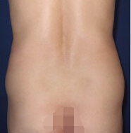 整形前后对比图片