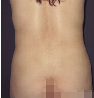 整形前后对比图片