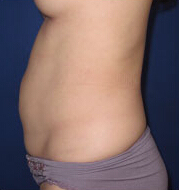 整形前后对比图片