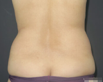 整形前后对比图片