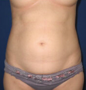 整形前后对比图片