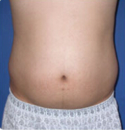 整形前后对比图片