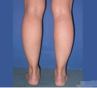 整形前后对比图片