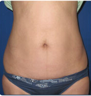 整形前后对比图片