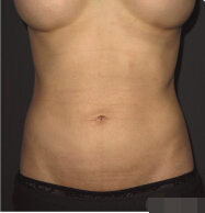 整形前后对比图片