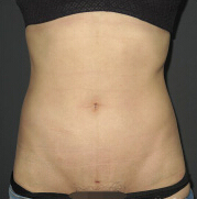 整形前后对比图片