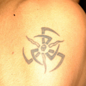 整形前后对比图片