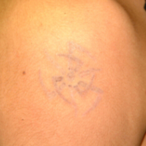 整形前后对比图片