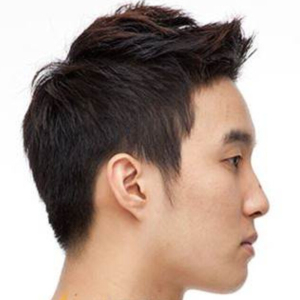 整形前后对比图片