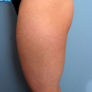 整形前后对比图片