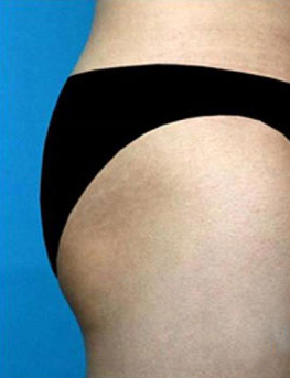 整形前后对比图片