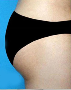 整形前后对比图片