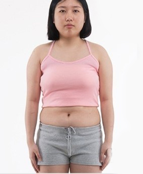 整形前后对比图片