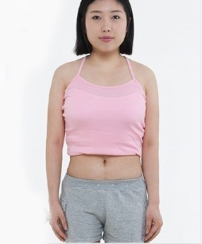 整形前后对比图片