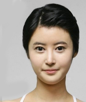 整形前后对比图片