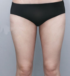 整形前后对比图片