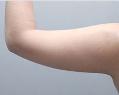 整形前后对比图片