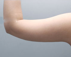 整形前后对比图片