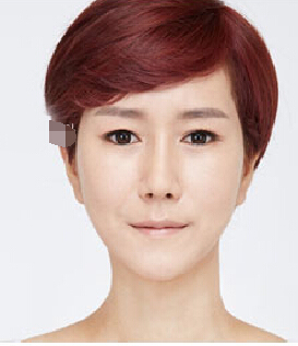 整形前后对比图片