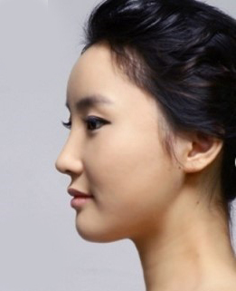 整形前后对比图片