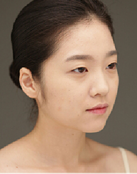 整形前后对比图片