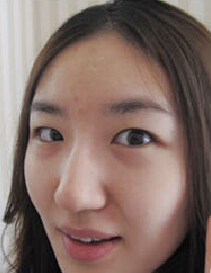 整形前后对比图片