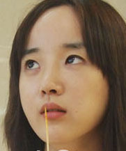 整形前后对比图片