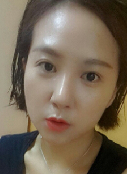 整形前后对比图片