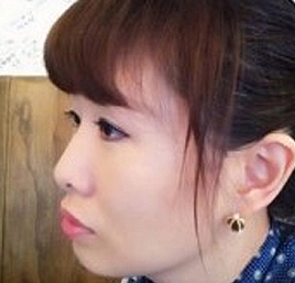 整形前后对比图片