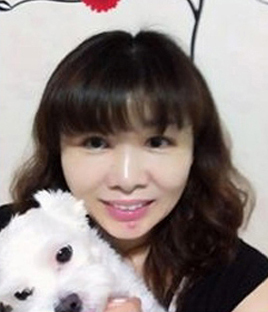 整形前后对比图片