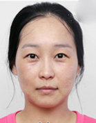 整形前后对比图片