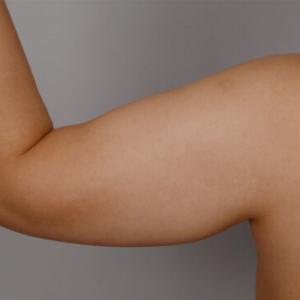 整形前后对比图片