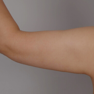 整形前后对比图片