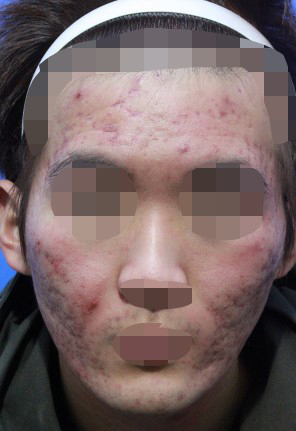 整形前后对比图片