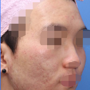 整形前后对比图片