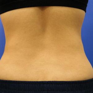 整形前后对比图片