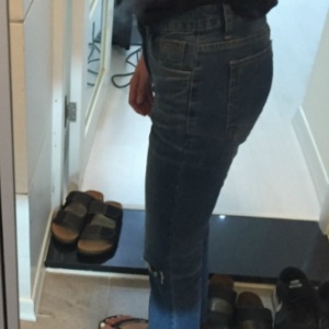 整形前后对比图片