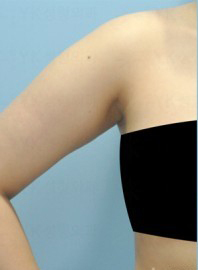 整形前后对比图片