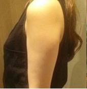 整形前后对比图片