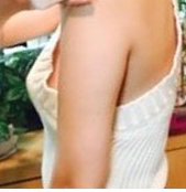 整形前后对比图片