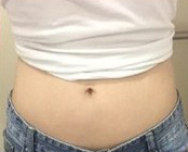 整形前后对比图片