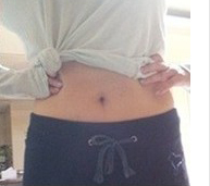 整形前后对比图片